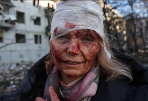 Photos Of heartbreaking scenes after deadly missile strikes plunge Ukraine into bloodshed on Putin war declaration