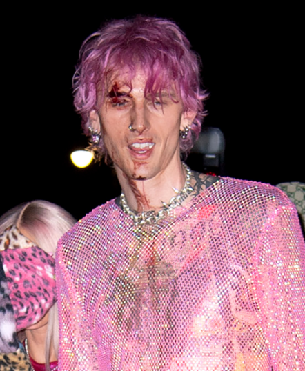 Video: Machine Gun Kelly smashes raw glass against his face, bleeds while performing at NYC afterparty