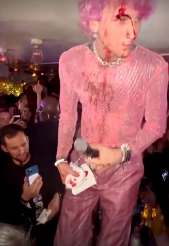 Video: Machine Gun Kelly smashes raw glass against his face, bleeds while performing at NYC afterparty