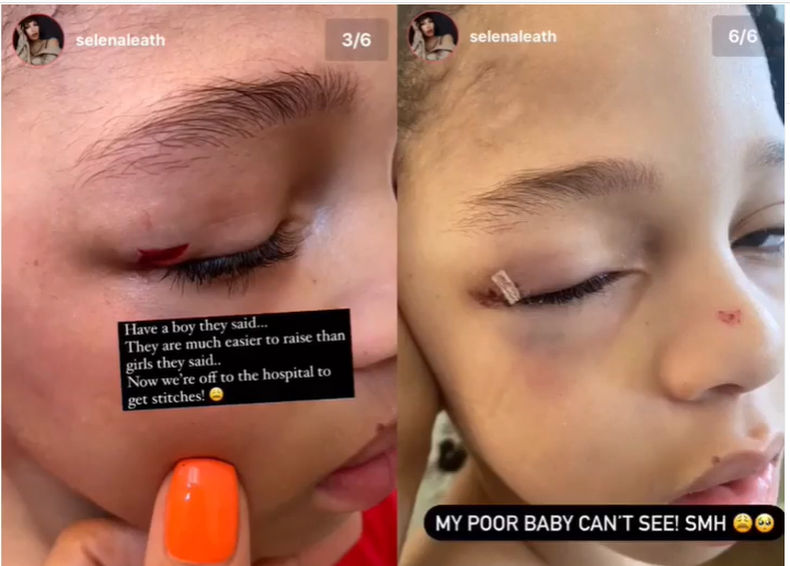 Runtown's son suffers an injury on the eye after he slipped and fell while running