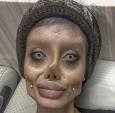 See 'Zombie Angelina Jolie' True Face After Release From jail