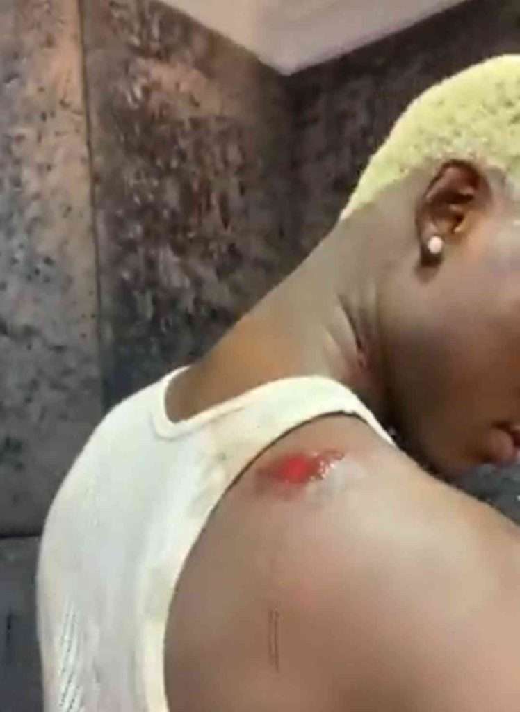 Singer Mohbad Share Photos Of Blood Stains After Accusing Marlian Music Of Assaulting Him