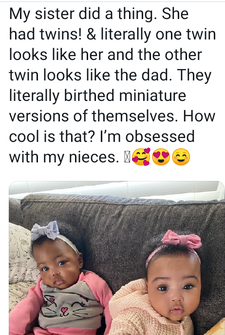 Photo of adorable twin girls born with different skin tones and are miniature versions of their parents